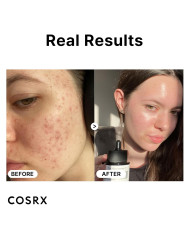 Serum de Niacinamida Cosrx